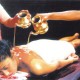 Ayurvedic Treatment