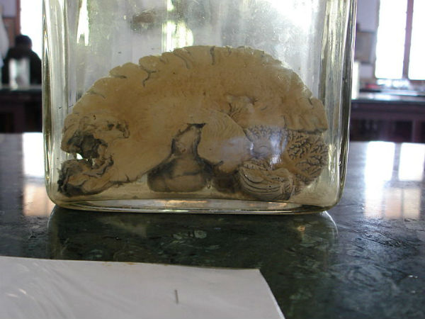 What To Do And See Inside This Brain Museum